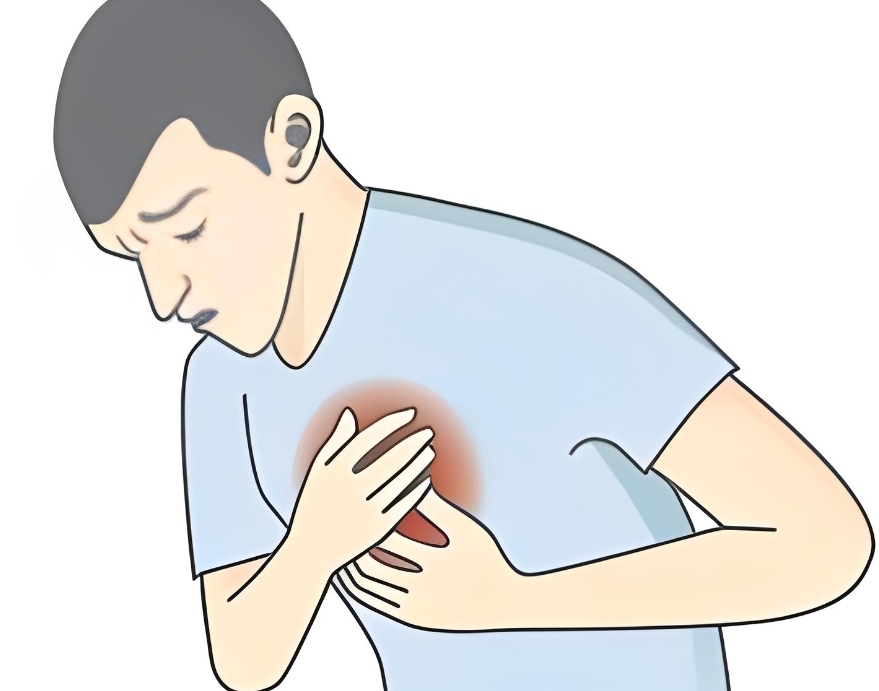 什么是阵发性室上性心动过速?