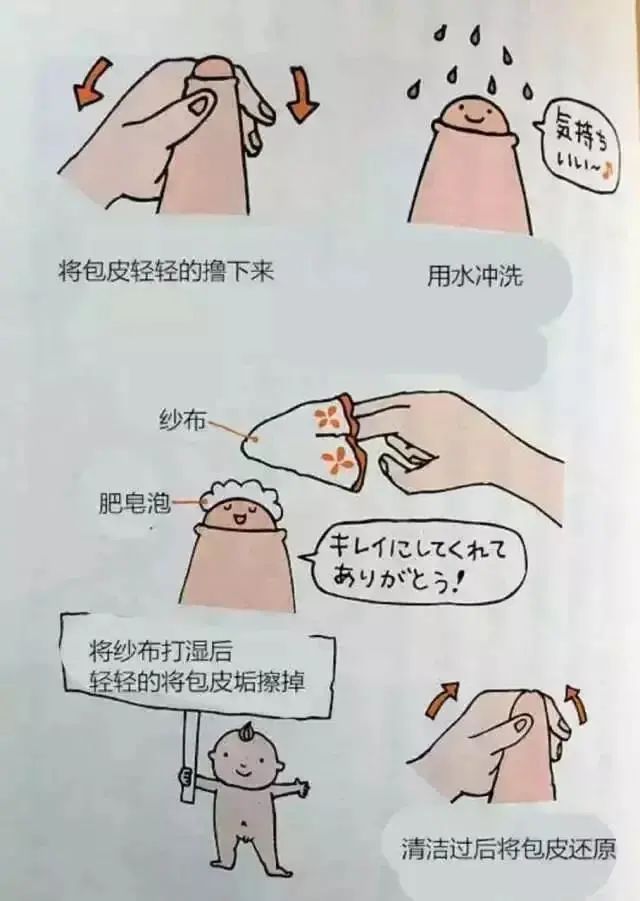 这种包茎,尽快割!