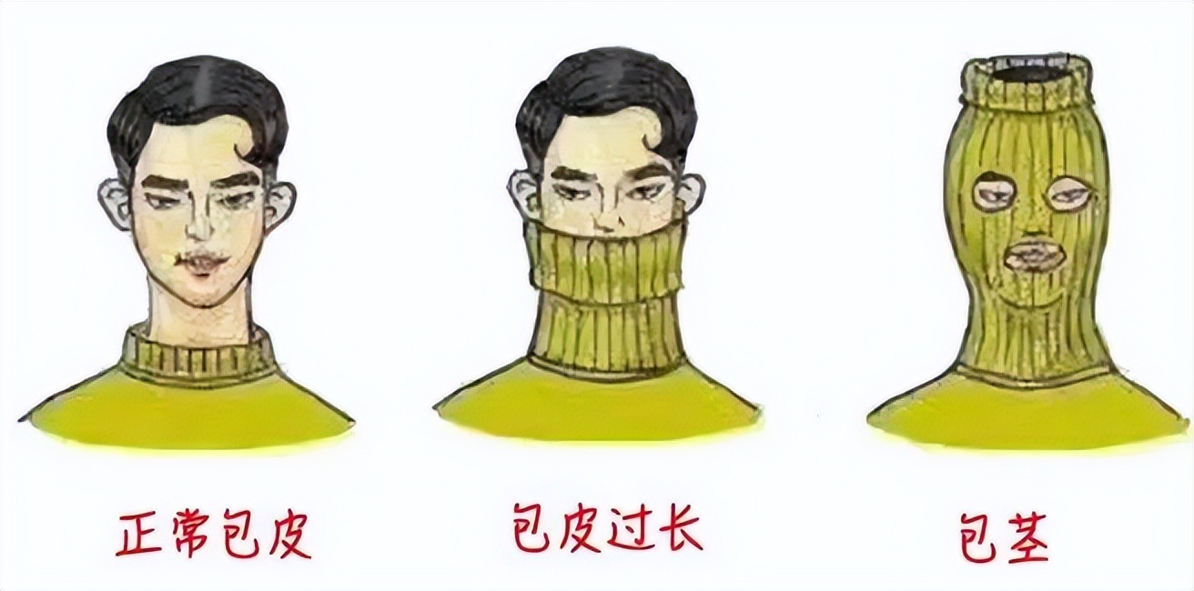 包皮一般有3种状态:正常,包皮过长,包茎.