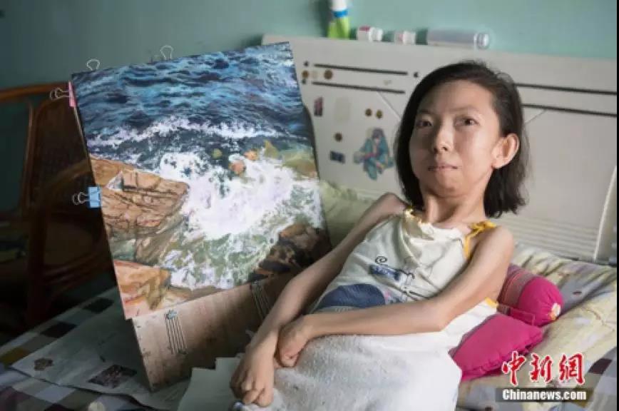 河南护士刘珊照料重伤病患时,手臂突然被患者咬住.