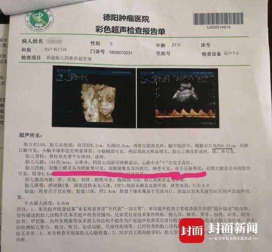 1556157245157726.jpg 3.jpg