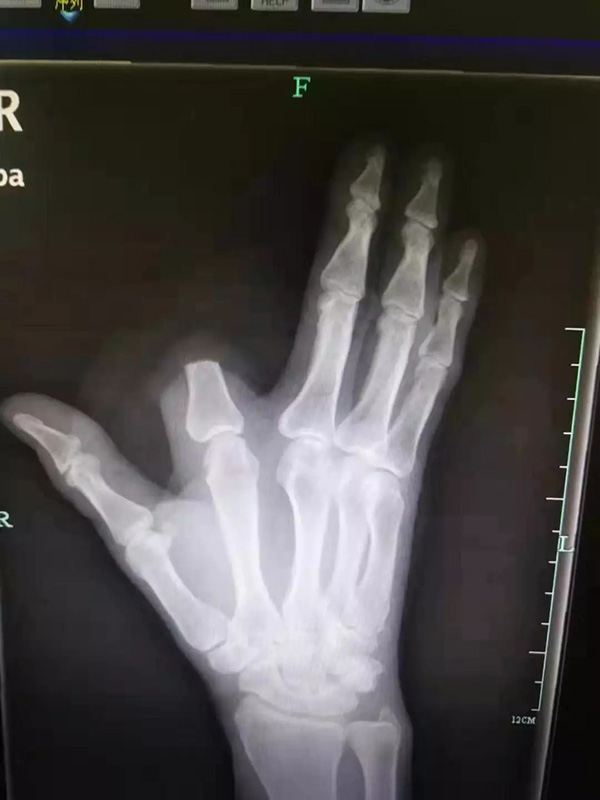 1572261795781707.jpg 623.jpg