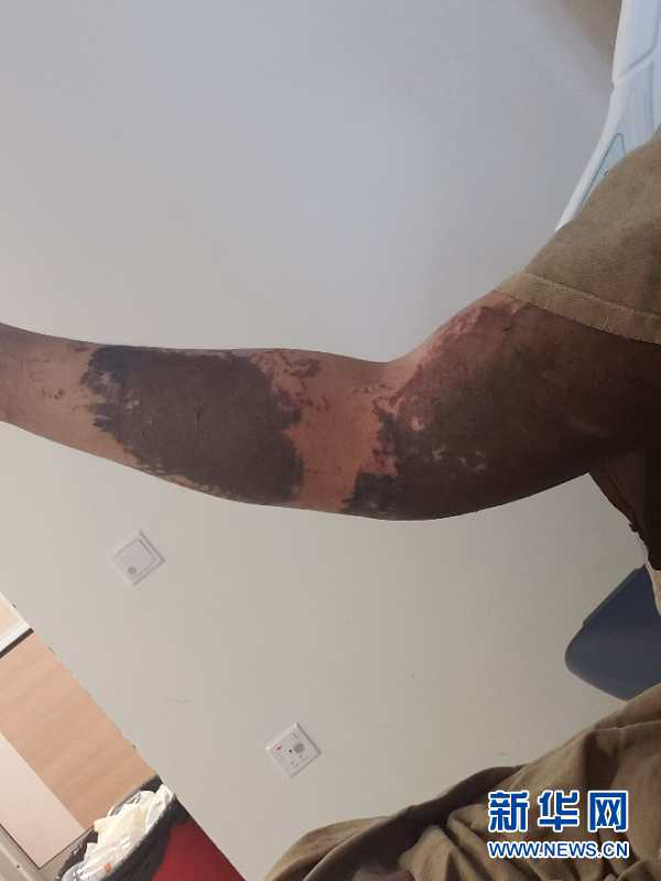 1589674167692159.png 图片3.png