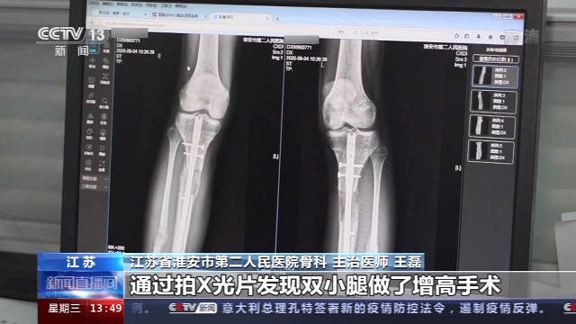 1602670812400505.jpg 35edae7c5606406697a42d377dd4306f_16x9.jpg