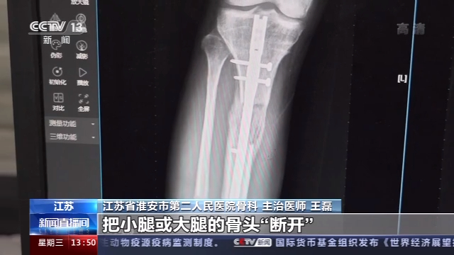 1602670845628461.jpg 3477e06d0fda4e0b83ca9c1859c6e07a_16x9.jpg