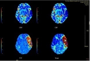 1698137286181162.png image.png