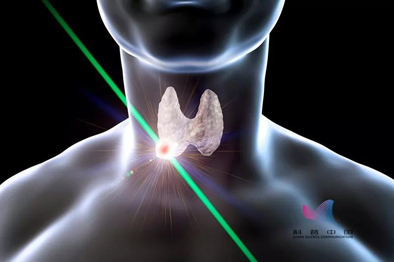 1厘米以下的甲状腺结节大可不必担心,若大于1厘米,建议定期复查.