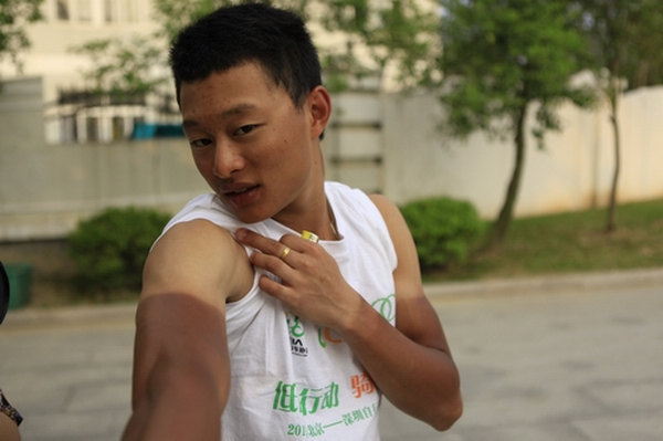 在烈日下暴晒多久会晒黑晒黑后多久才能白回来