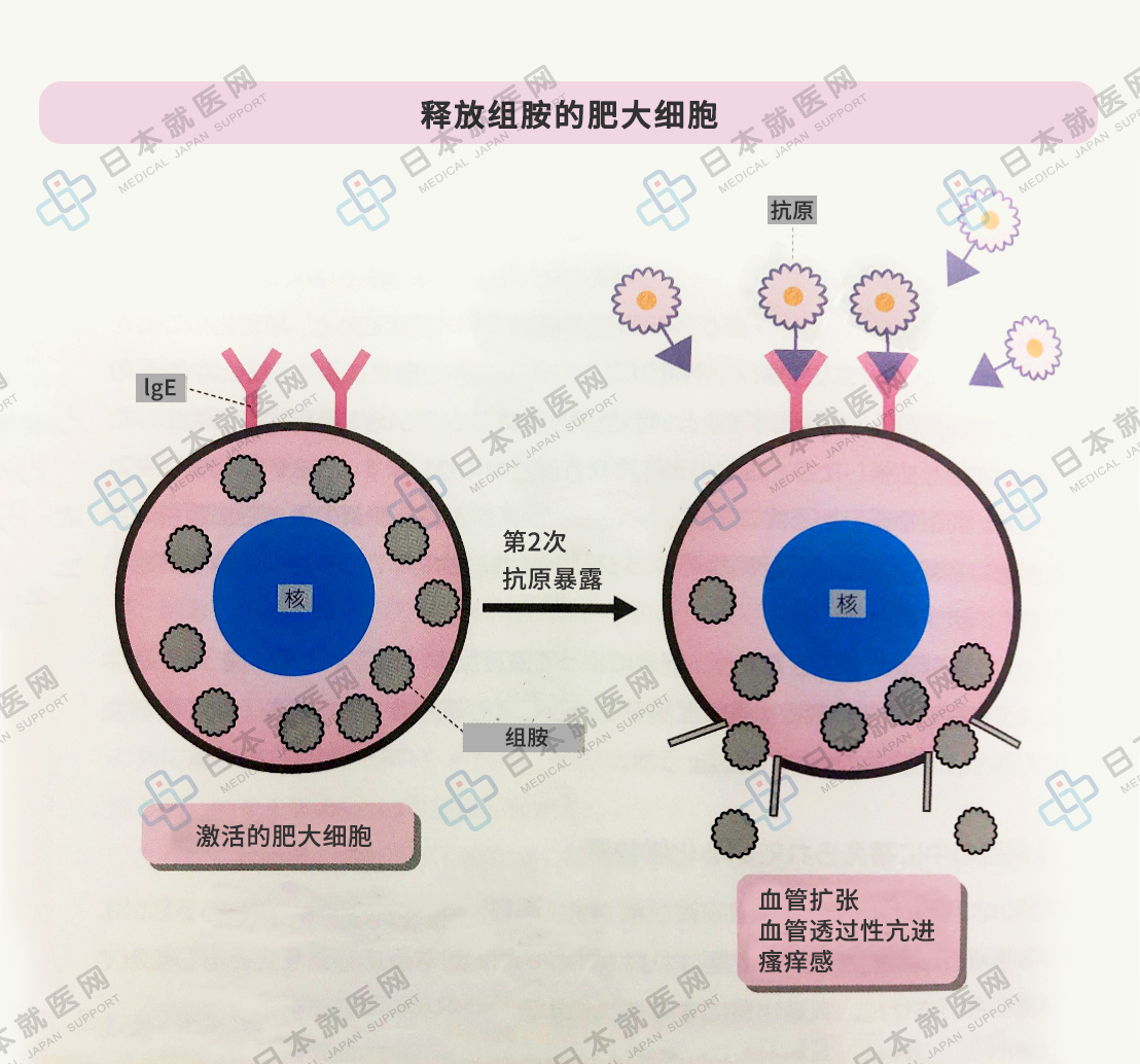 炎症是如何发生的