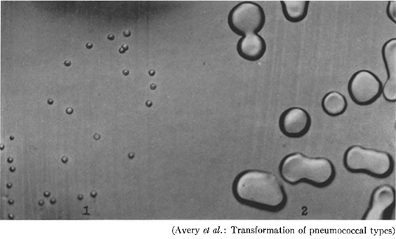 肺炎双球菌荚膜图片