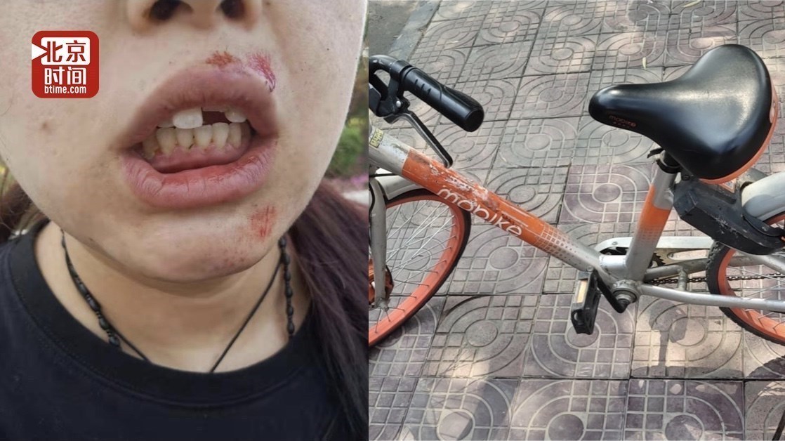 女子骑故障摩拜单车磕掉两颗门牙摩拜官方表示正在采证