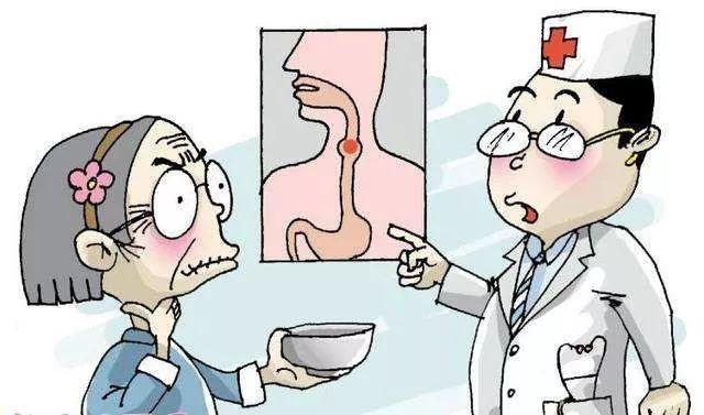 求证吞咽障碍能告别鼻饲管吗