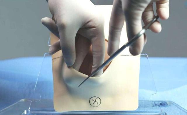 宁愿肚皮缝合一小时,也不愿侧切?4个侧切环节,容易有心理障碍