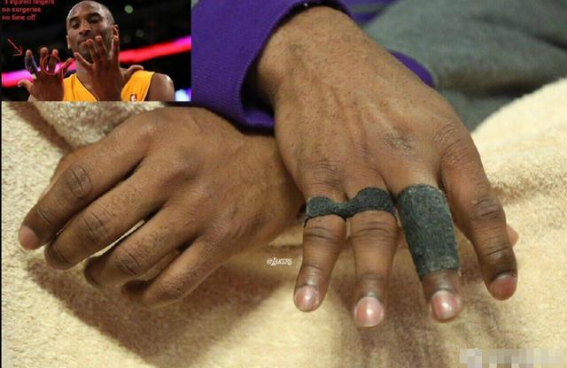 其实不止乔治如此,nba不少球星都有五指变形的情况.