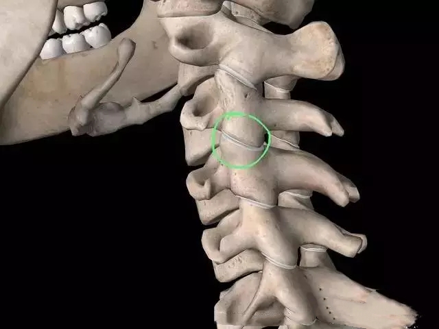 颈椎,下图2,关节突关节每一个独立的椎体上面和下面都有关节突