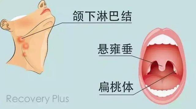 咽和扁桃体的位置图片图片