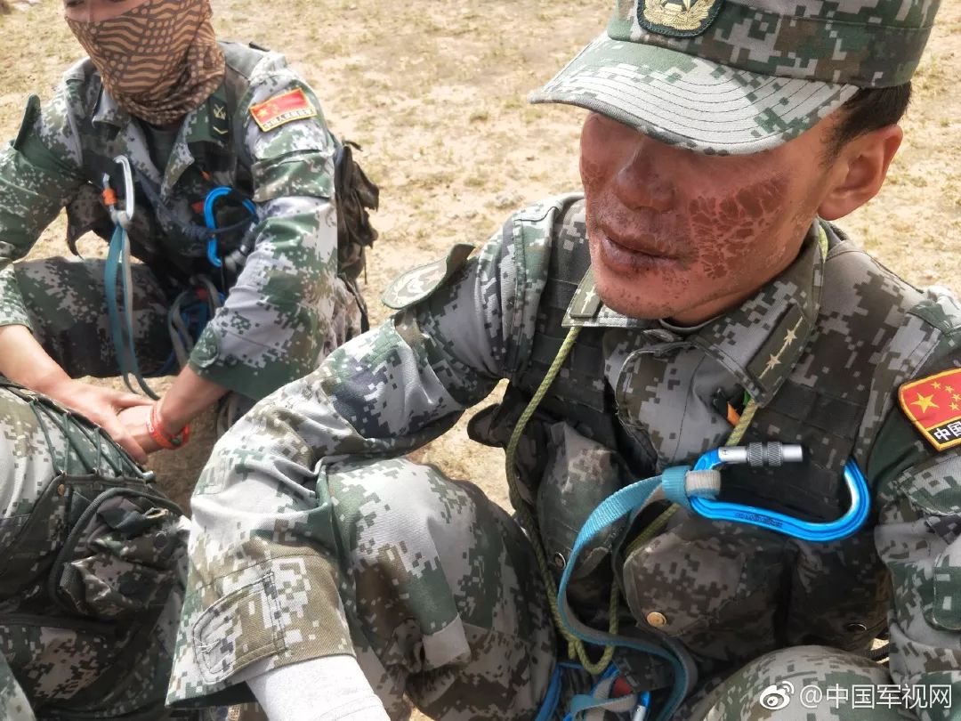 边防战士受伤的脸高清图片