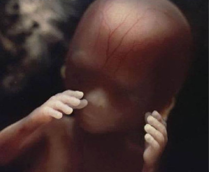 十八周胎儿真实图片图片