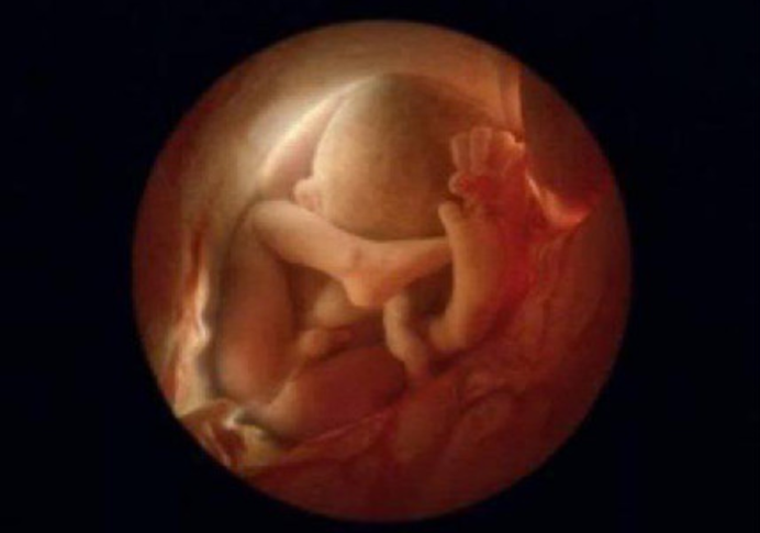 十八周胎儿发育图片图片