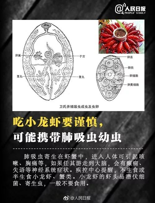 女子肚痛一个月,检查发现肝吸虫卵!