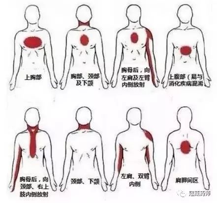 《生死竞速》科普心梗急救常识 视频,千万别错过!