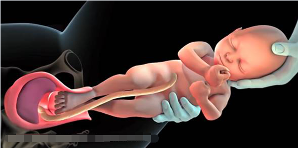 胎儿被娩出的5个步骤,看完后被妈妈和宝宝感动,简直太伟大!