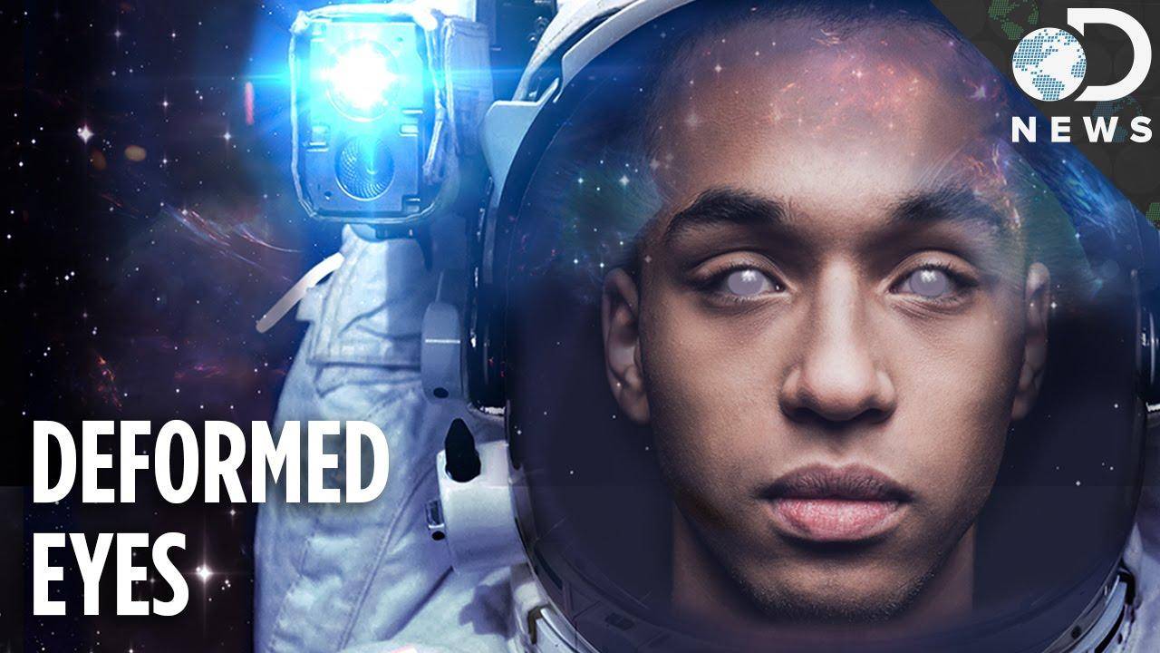 天文在线@如果我们去太空旅行，会不会导致失明？