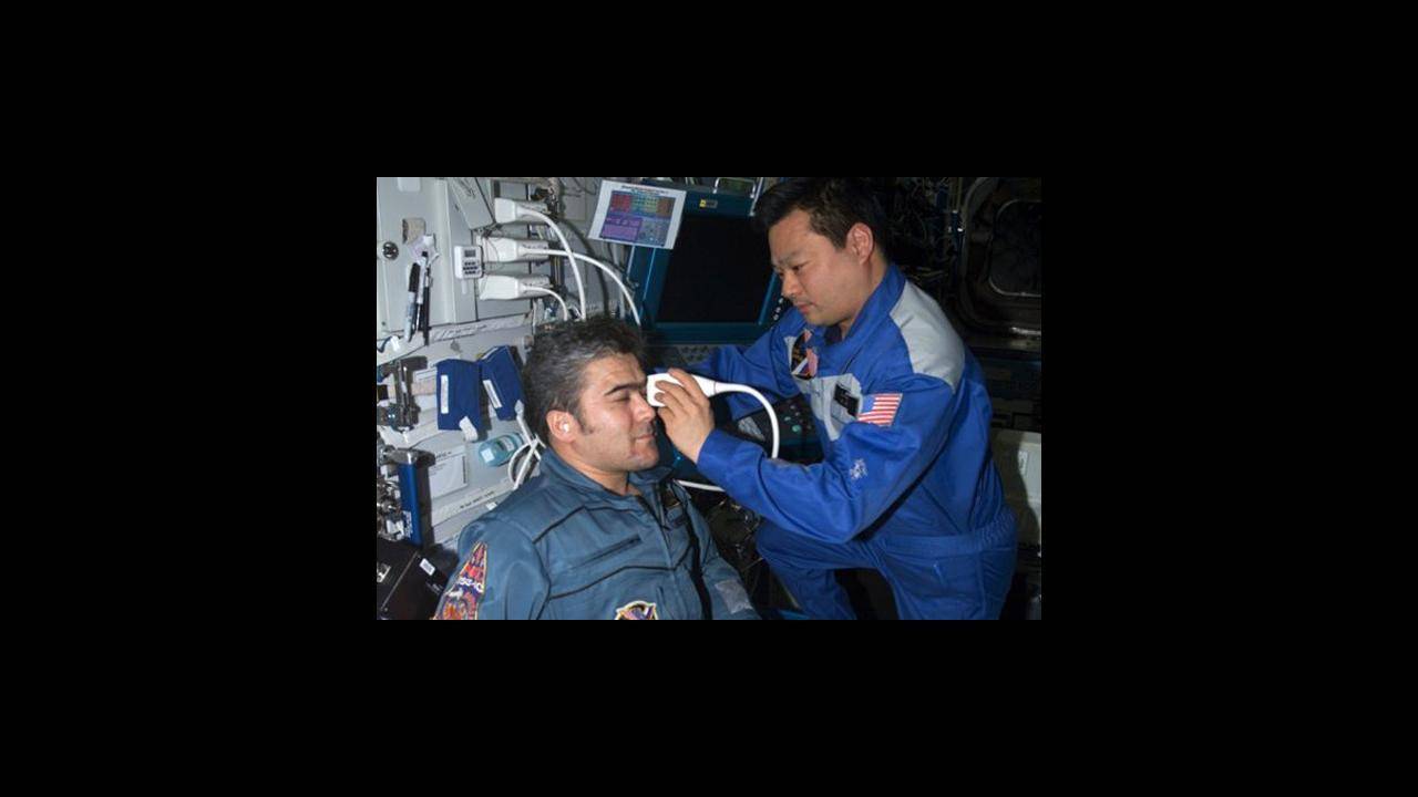 天文在线@如果我们去太空旅行，会不会导致失明？