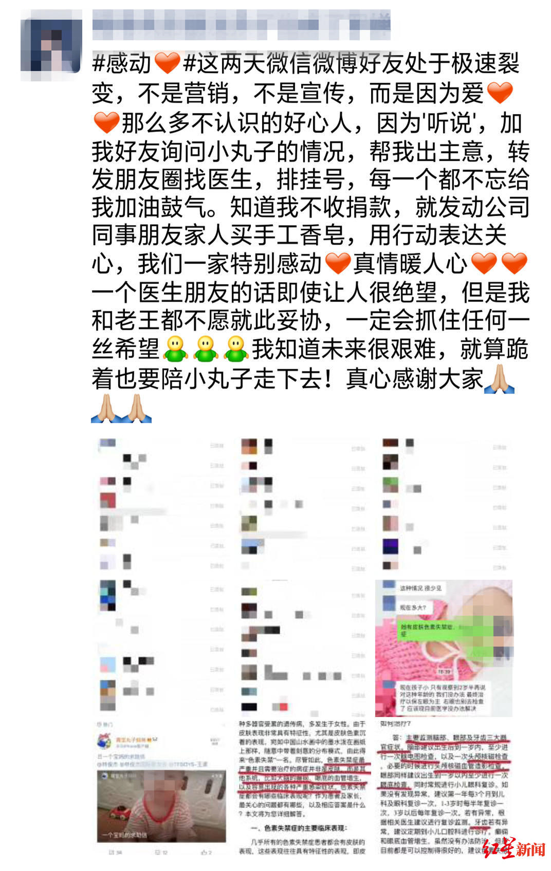 「红星新闻」出生就患“怪病”，母亲卖香皂救女：今天也是为小丸子加油的一天