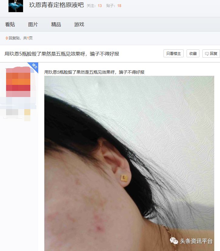 「中国质量万里行」玖恩青春定格液屡遭“责令改正”如此宣传是否对消费者存在误导？