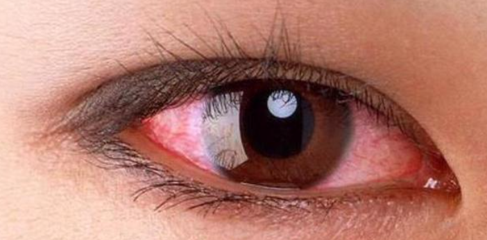 眼睛如果出现这些症状一定要重视,快去看医生吧!