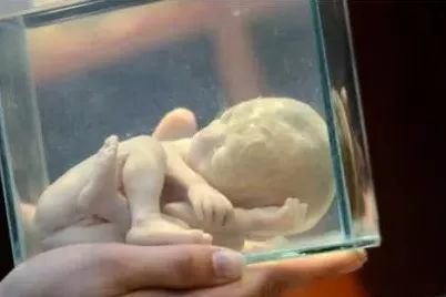 「半岛晨报」妇科医生去世后，家中搜出2000多具尸体