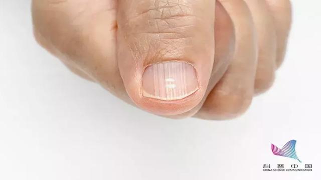 【科普中国】指甲上的月牙竟是身体的“晴雨表”？这些真相你一定要知道……