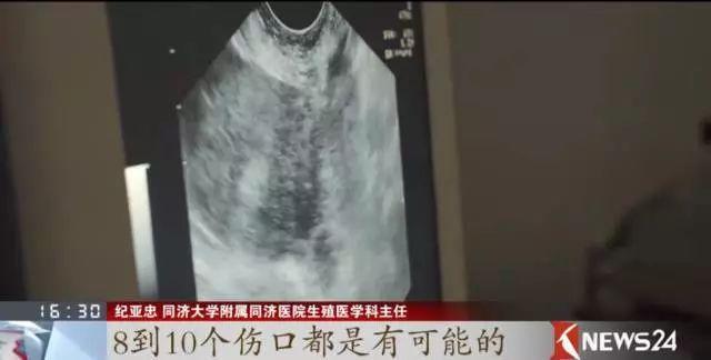 【安图广播电视台】假精致的背后，其实榨干了很多年轻人