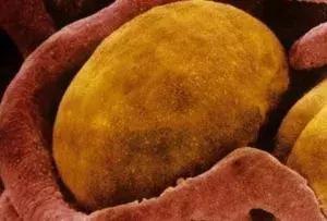 「科普中国」为什么长胖容易，瘦下来却很难？只因大多都……