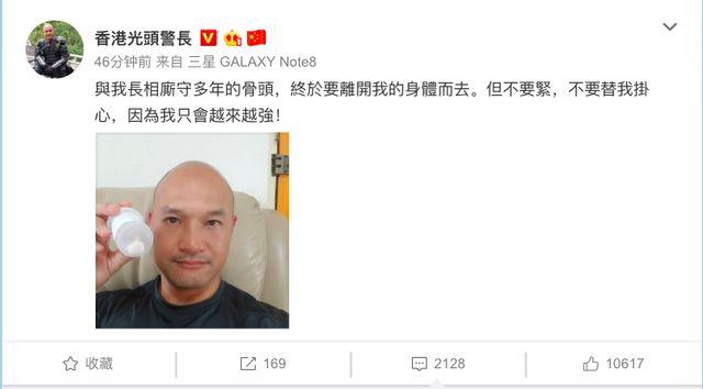 #生活报#港警光头刘Sir膝盖碎骨已取出！被暴徒掷砖击中带伤执勤4个月