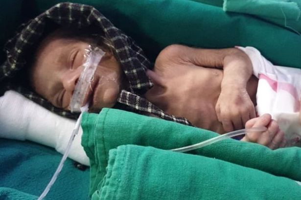 「环球时报」印度村民从地下陶罐救出刚被活埋的一女婴