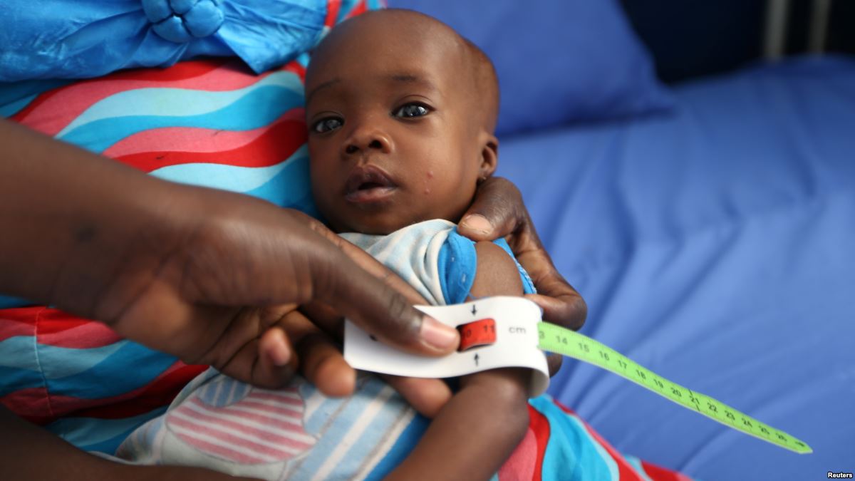 「环球时报」联合国报告：全球三分之一幼儿营养不良或超重