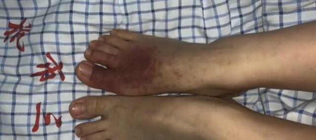 「海峡消费报」女子外出住酒店，第二天察觉身体不舒服，负责人：拿出证据赔10万
