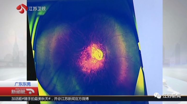 「中国质量万里行」少年近视2400度，散光250度！这个坏习惯或许你也有