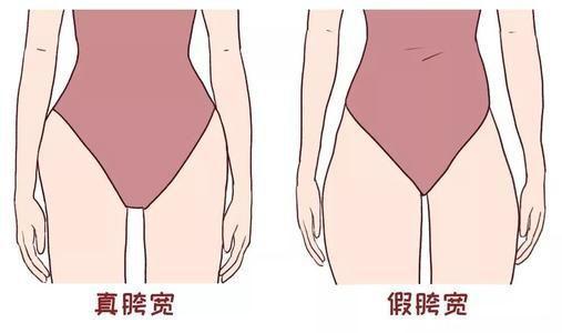 求实瑜伽丨产后梨形臀大腿变的短粗有可能是假胯宽