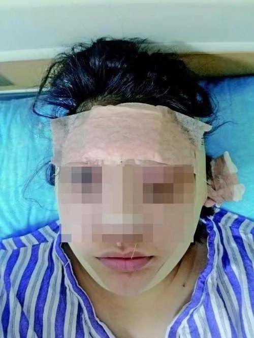 「中青评论」要想红先整容？小心“整容贷”的坑