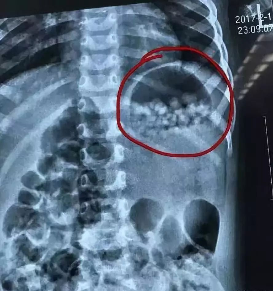「中国教育报」这8种致命网红毒玩具，千万别给孩子买！快看看你家有吗｜精选