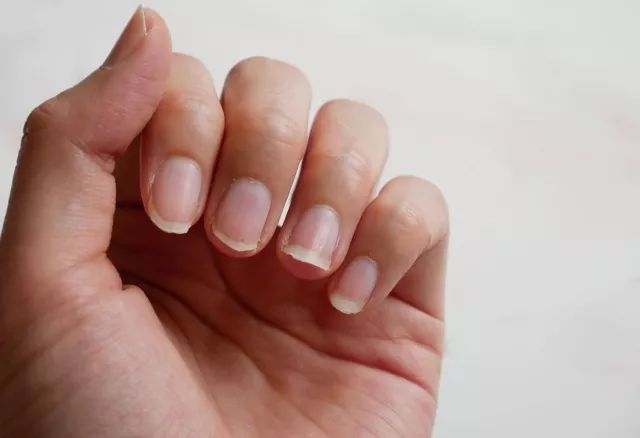 「中国计划生育协会」「健康」女性｜气血不好，人易老！从这5个部位就能看出来