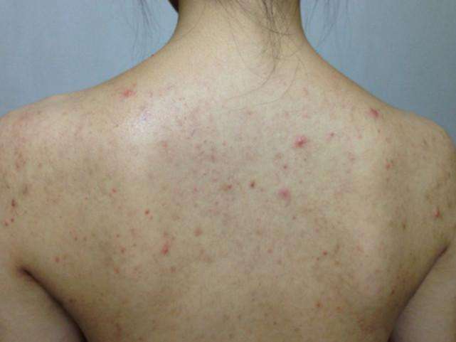 刘诗诗的蝴蝶背火了精致的女人都开始美背了