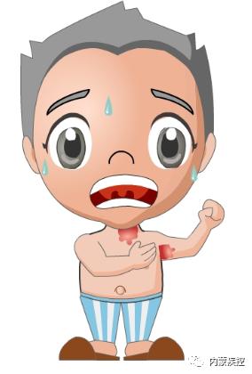 【奈曼旗新闻】「权威解读」关于鼠疫的相关知识