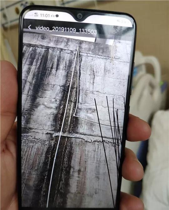「半岛晨报」奇迹！13岁男孩二楼坠下，钢筋贯穿身体，心脏收缩避开致命一击！