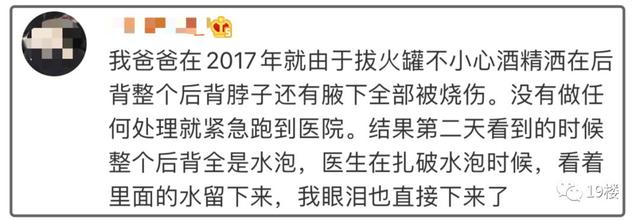 「生活报」女演员发文曝拔火罐被深二度烧伤，专家：注意事项要谨记