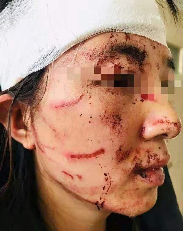 温州一女子在路口遭公公和丈夫暴打,当地妇联和公安介入