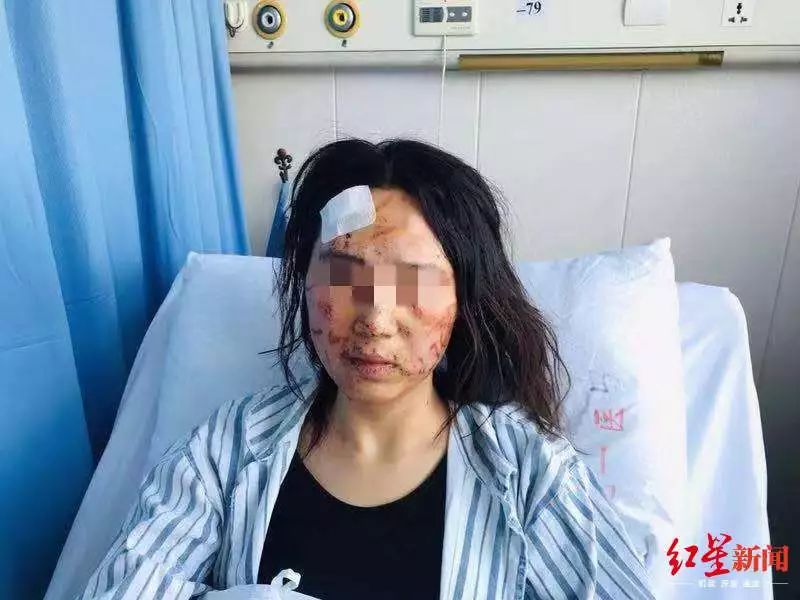[半岛都市报]女子遭丈夫、公公当街暴打涂粪，几近破相！女方：结婚嫁妆200万